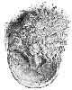A FOOT, THE SUBJECT OF CANKER, SHOWING DESTRUCTION OF THE HORNY FROG, AND A FUNGOID-LOOKING HYPERTROPHY OF THE TISSUES BENEATH.