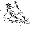 DIAGRAM SHOWING THE COURSE TAKEN BY THE NEEDLE WHEN SETONING THE FROG.
