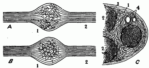 Fig. 128—Diagrams illustrating arrangement of neurons. A, B. Ganglia and short segments of nerves. 1. Ganglion. 2. Nerve. In the ganglion of A are end-to-end connections of different neurons; in the ganglion of B are the cell-bodies of di-axonic neurons. C. Section of a nerve trunk. 1. Epineurium consisting chiefly of connective tissue. 2. Bundles of nerve fibers. 3. Covering of fiber bundle, or perineurium. 4. Small artery and vein. Fig. 128