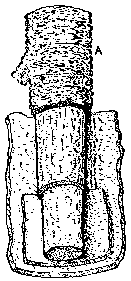 Fig. 19—Artery dissected to show the coats. Fig. 19