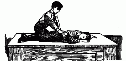 Fig. 48—Artificial respiration. Inspiration. Fig. 48