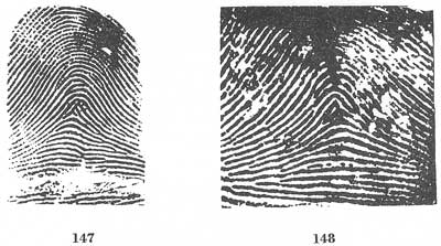 Figs. 147-148 Figs. 147-148