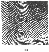 Fig. 149 Fig. 149
