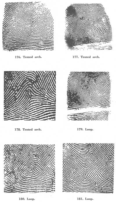 Figs. 176-181 Figs. 176-181