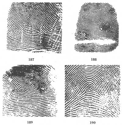 Figs. 187-190 Figs. 187-190
