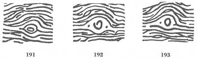 Figs. 191-193 Figs. 191-193