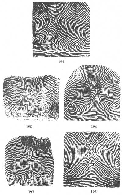 Figs. 194-198 Figs. 194-198