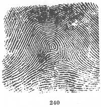 Fig. 240 Fig. 240