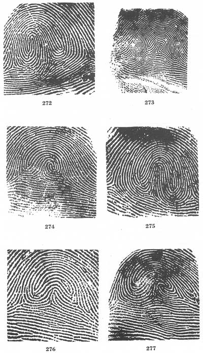 Figs. 272-277 Figs. 272-277