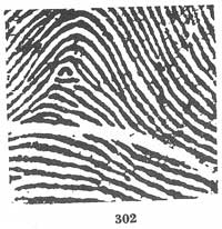 Fig. 302 Fig. 302