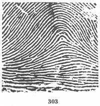 Fig. 303 Fig. 303