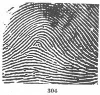 Fig. 304 Fig. 304