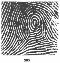 Fig. 305 Fig. 305