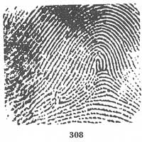 Fig. 308 Fig. 308