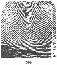 Fig. 309 Fig. 309