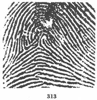 Fig. 313 Fig. 313