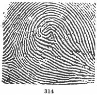 Fig. 314 Fig. 314