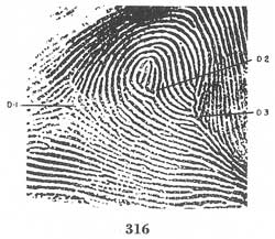 Fig. 316 Fig. 316