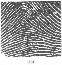 Fig. 331 Fig. 331