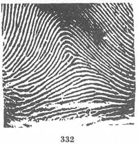 Fig. 332 Fig. 332