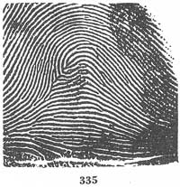 Fig. 335 Fig. 335