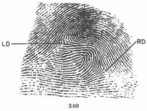 Fig. 340 Fig. 340