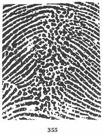 Fig. 355 Fig. 355