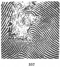 Fig. 357 Fig. 357