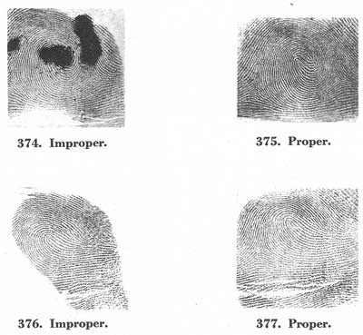 Figs. 374-377 Figs. 374-377