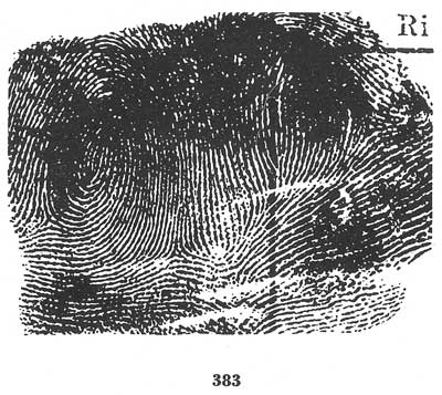 Fig. 383 Fig. 383
