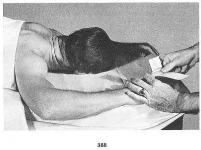 Fig. 388 Fig. 388