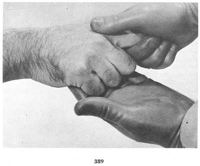 Fig. 389 Fig. 389