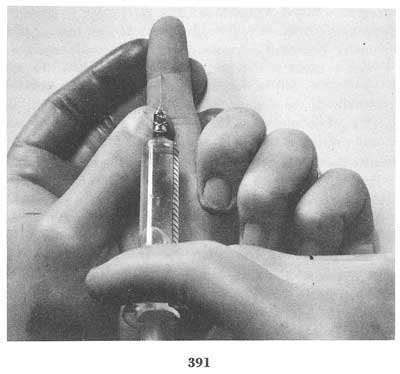 Fig. 391 Fig. 391