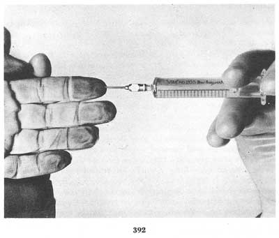 Fig. 392 Fig. 392