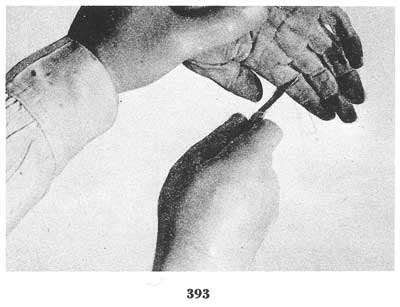 Fig. 393 Fig. 393