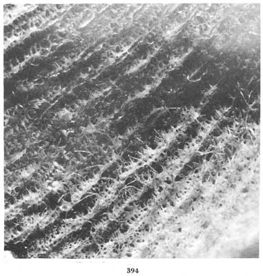 Fig. 394 Fig. 394