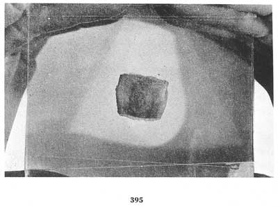 Fig. 395 Fig. 395