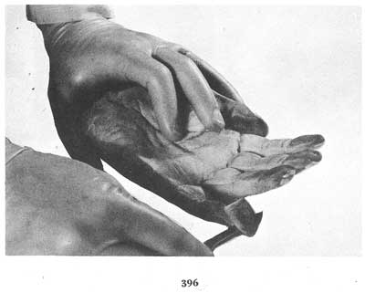 Fig. 396 Fig. 396