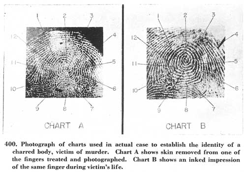 Fig. 400 Fig. 400