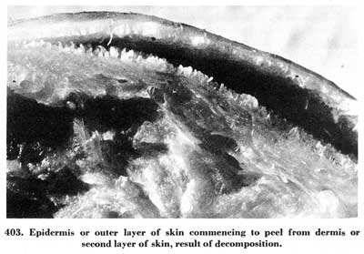 Fig. 403 Fig. 403