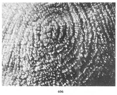 Fig. 406 Fig. 406