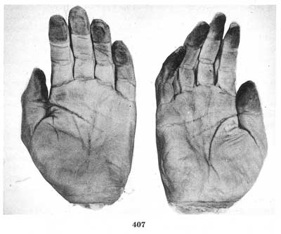 Fig. 407 Fig. 407