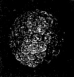 The contents of an ovum in an advanced stage of segmentation.