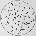Germs