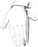 see text