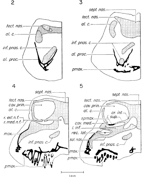 Transverse sections through anterior end of skull Transverse sections through anterior end of skull