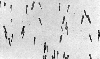 Vertical tadpoles on barely visible gelatinous threads.