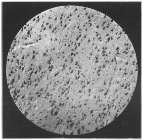 Photo, Cornell University Medical School   MICROPHOTOGRAPH OF BRAIN TISSUE