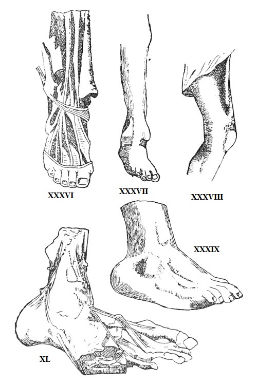 FRACTURES, ETC.