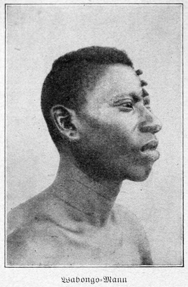 Wabongo-Mann